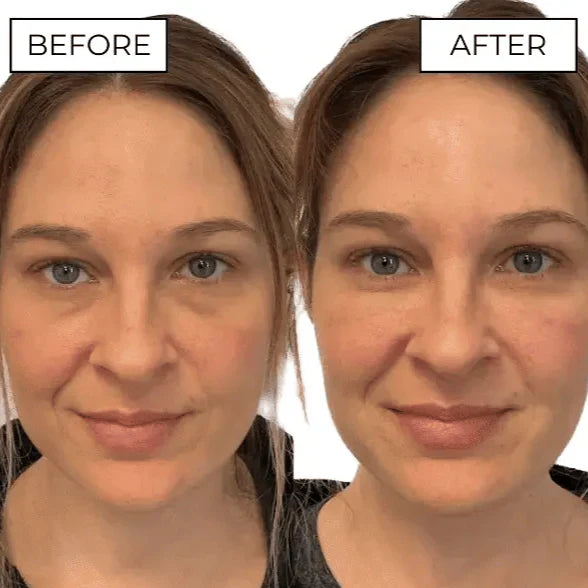 Eye Massager Relieves Eye