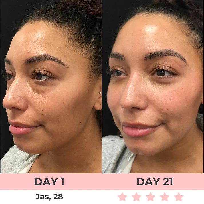 Eye Massager Relieves Eye