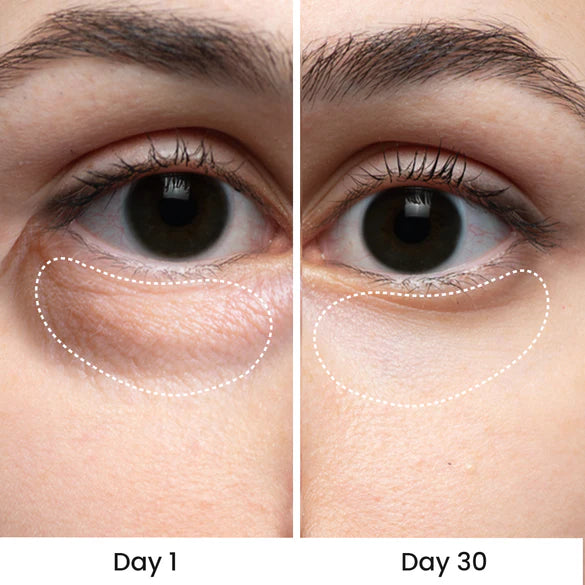 Eye Heating Vibration