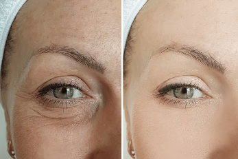 Eye Massager Relieves Eye